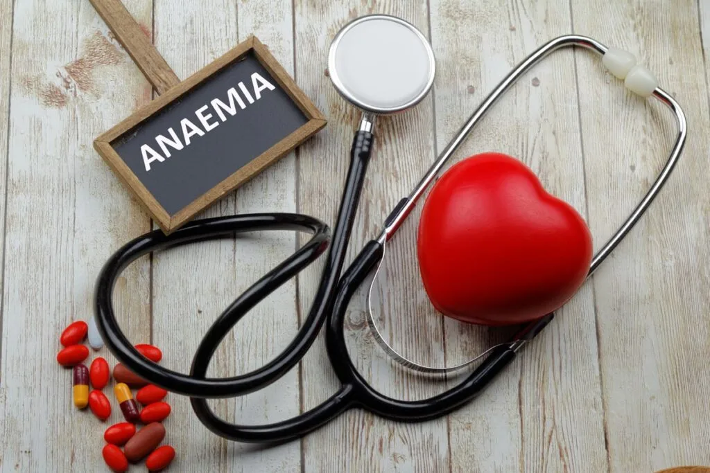 Anemia may influence in how many iron infusions do you need