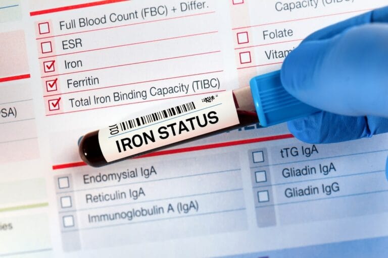 Blood sample labeled "Iron Status" on a medical test form, highlighting the importance of testing iron levels for health diagnostics.