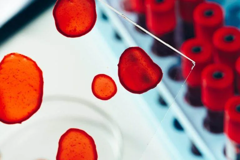 Close-up view of blood samples on a slide and test tubes in a lab, highlighting low platelet count research.