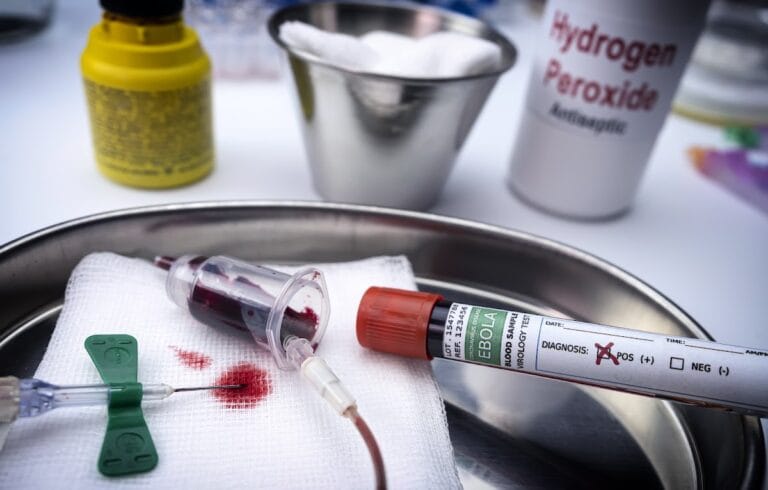 A close-up of medical equipment including a syringe with blood, a labeled blood sample tube marked "Ebola," and antiseptic materials on a tray, with a bottle of hydrogen peroxide visible in the background.