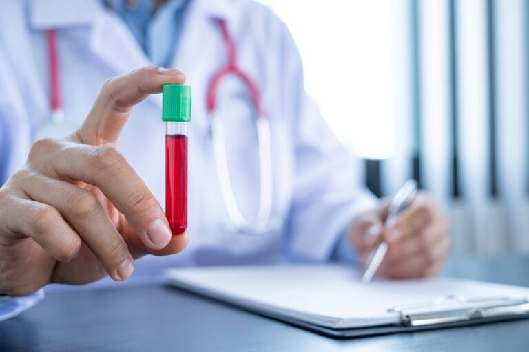 Doctor holding blood sample vial